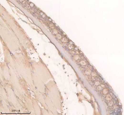 Anti-Zebrafish TRPM2 Antibody Boster Bio