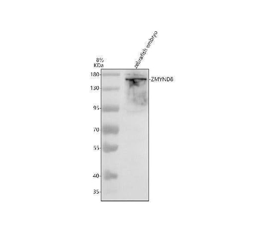 Anti-Zebrafish ZMYND8 Antibody Picoband® Boster Bio
