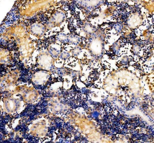 Anti-Zebrafish Vitamin D binding protein/GC Antibody Boster Bio