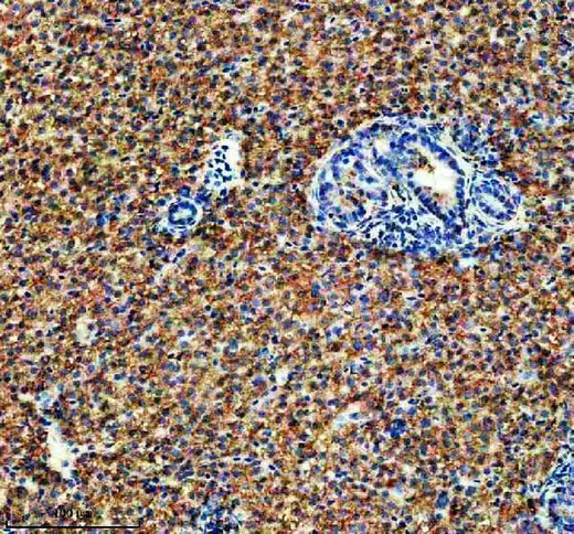Anti-Zebrafish IDH3B Antibody Boster Bio
