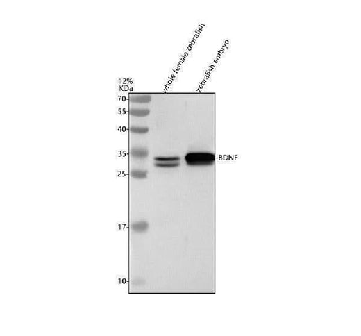 Anti-Zebrafish BDNF Antibody Picoband® Boster Bio