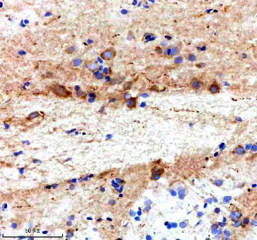 Anti-Zebrafish TTC28 Antibody Boster Bio
