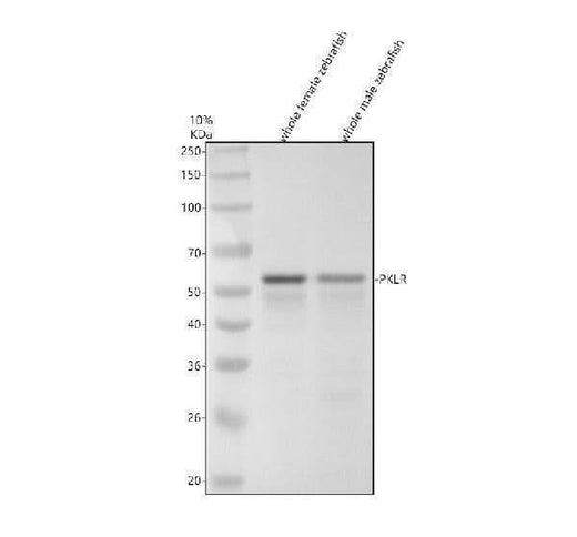 Anti-Zebrafish PKLR Antibody Picoband® Boster Bio