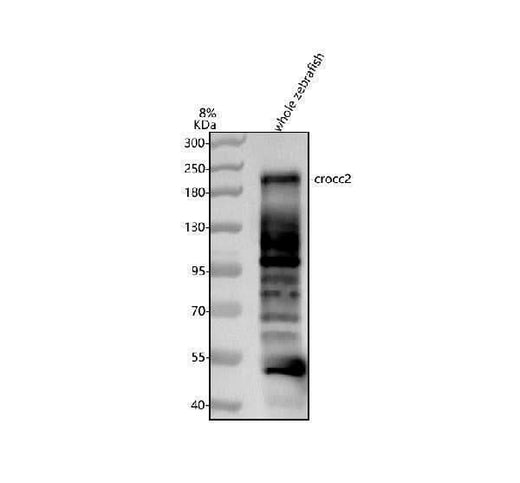 Anti-Zebrafish CROCC2 Antibody Picoband® Boster Bio