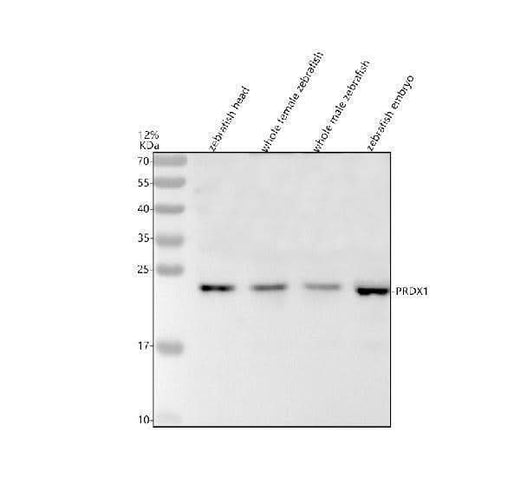 Anti-Zebrafish PRDX1 Antibody Picoband® Boster Bio