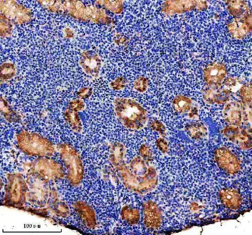 Anti-Zebrafish P5CS/ALDH18A1 Antibody Boster Bio
