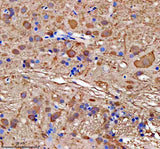 Anti-Zebrafish GMPS Antibody Boster Bio