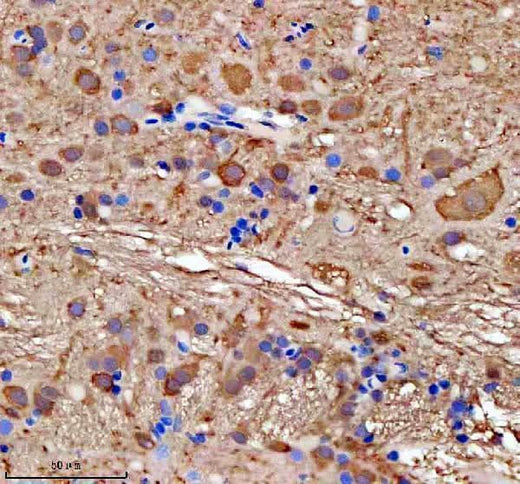Anti-Zebrafish GMPS Antibody Boster Bio