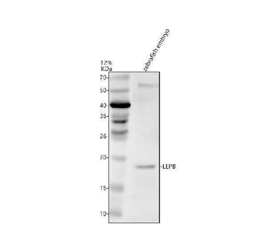 Anti-Zebrafish LEPB Antibody Picoband® Boster Bio
