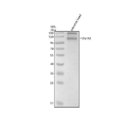 Anti-Zebrafish PDGFRB Antibody Picoband® Boster Bio