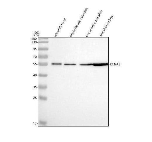 Anti-Zebrafish Kv1.2/KCNA2 Antibody Picoband® Boster Bio