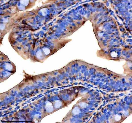Anti-Zebrafish VPS53 Antibody Boster Bio