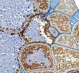 Anti-Zebrafish HSD17B1 Antibody Boster Bio