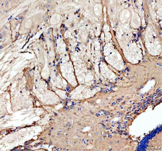 Anti-Zebrafish GRIN1a/b Antibody Boster Bio