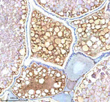 Anti-Zebrafish NDR1 Antibody Boster Bio