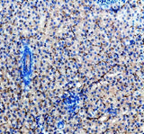 Anti-Zebrafish ACVR1L Antibody Boster Bio