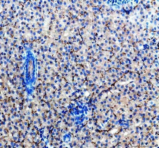 Anti-Zebrafish ACVR1L Antibody Boster Bio