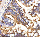 Anti-Zebrafish AXIN2 Antibody Boster Bio