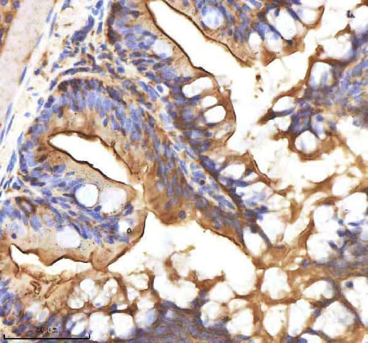 Anti-Zebrafish AXIN2 Antibody Boster Bio