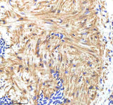 Anti-Zebrafish HAND2 Antibody Boster Bio