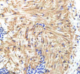Anti-Zebrafish HAND2 Antibody Boster Bio