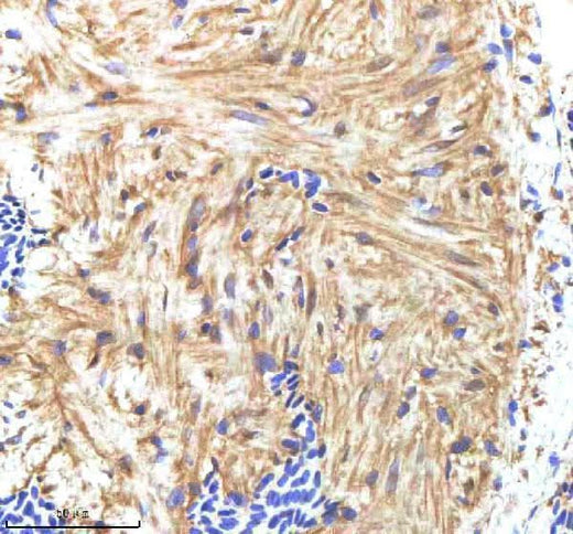 Anti-Zebrafish HAND2 Antibody Boster Bio