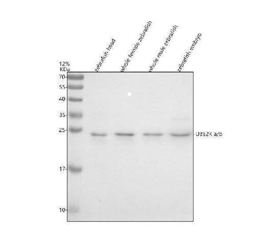 Anti-Zebrafish UBE2Ka/b Antibody Picoband® Boster Bio
