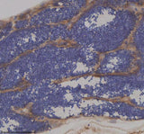 Anti-Zebrafish IFT172 Antibody Boster Bio