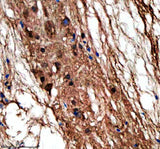 Anti-Zebrafish LIN9 Antibody Boster Bio