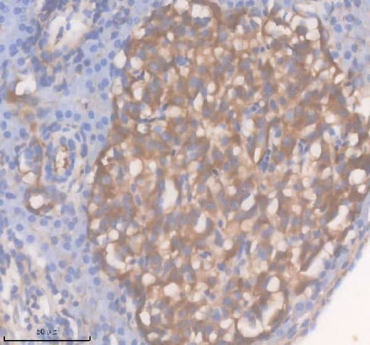 Anti-Zebrafish ACOX1 Antibody Boster Bio