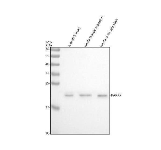 Anti-Zebrafish DJ-1/PARK7 Antibody Picoband® Boster Bio