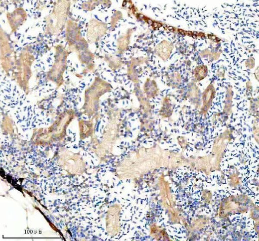 Anti-Zebrafish FHL2a/b Antibody Boster Bio