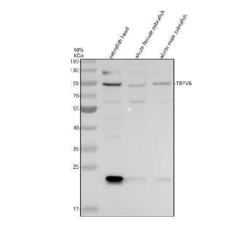 Anti-Zebrafish TRPV6 Antibody Picoband® Boster Bio
