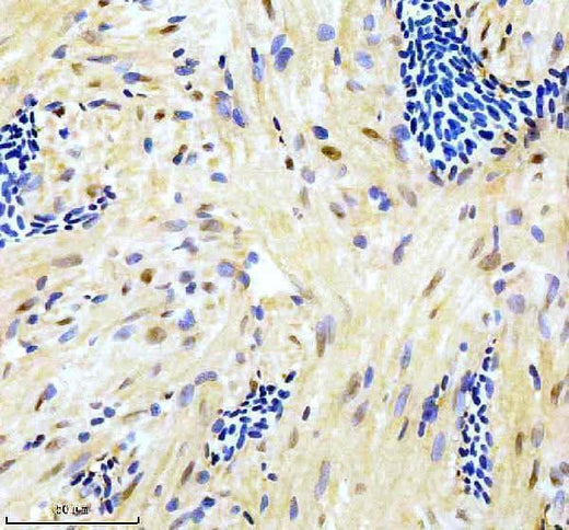 Anti-Zebrafish GATA6 Antibody Boster Bio