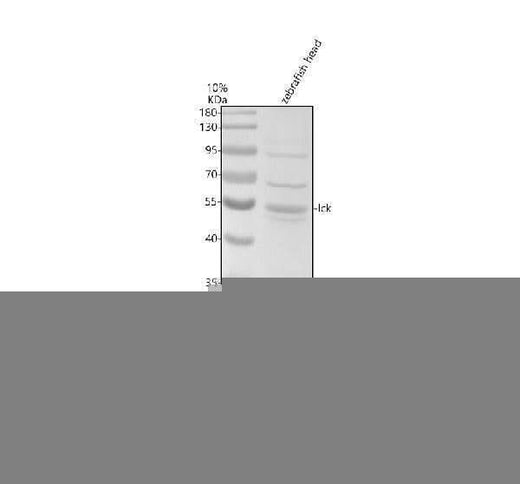 Anti-Zebrafish LCK Antibody Picoband® Boster Bio