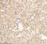 Anti-Zebrafish PGAM1a/b Antibody Boster Bio