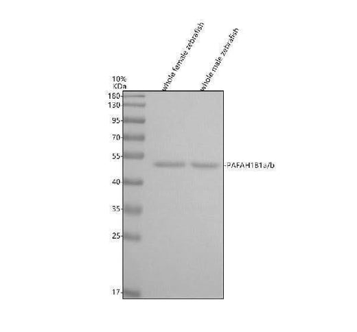 Anti-Zebrafish PAFAH1B1a/b Antibody Picoband® Boster Bio