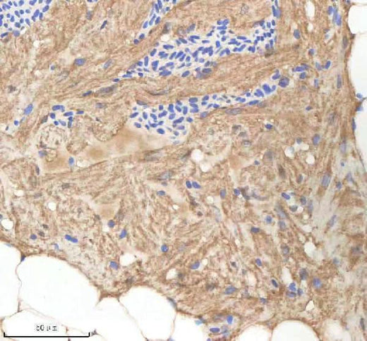 Anti-Zebrafish NPLOC4 Antibody Boster Bio
