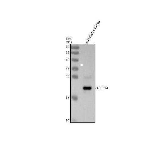 Anti-Zebrafish ASCL1A Antibody Picoband® Boster Bio