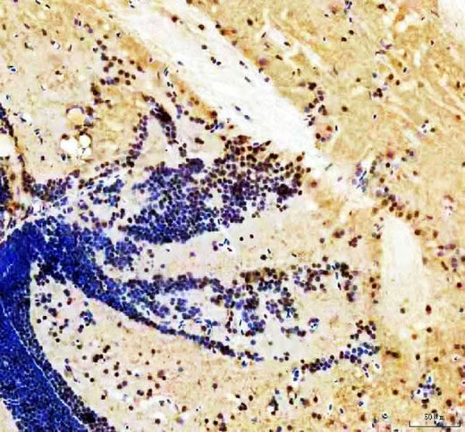 Anti-Zebrafish HER4(1+2+3+5) Antibody Boster Bio