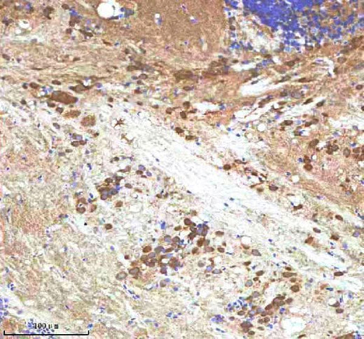 Anti-Zebrafish IGF1 Antibody Boster Bio