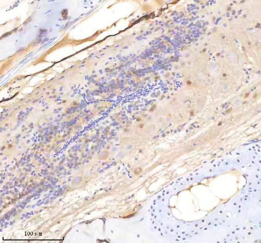 Anti-Zebrafish SF3A1 Antibody Boster Bio
