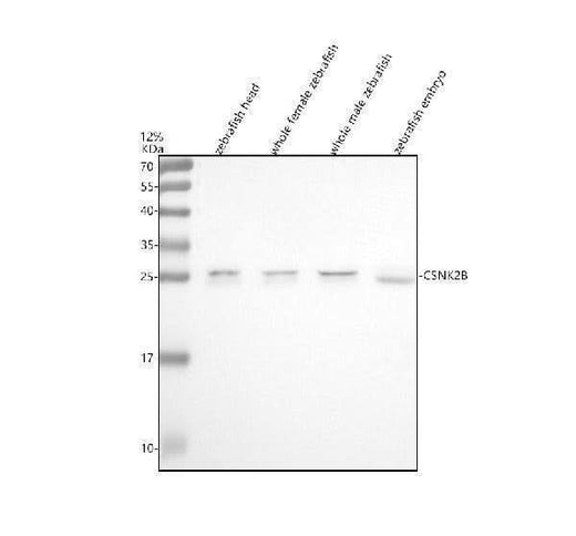 Anti-Zebrafish CSNK2B Antibody Picoband® Boster Bio