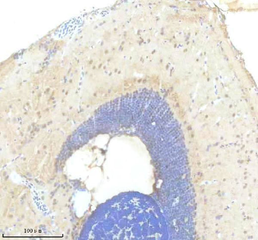 Anti-Zebrafish FOXC1A Antibody Boster Bio