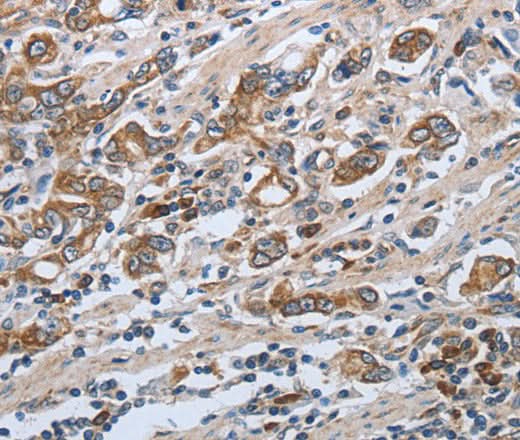 Anti-Human SLC34A2 Antibody - ABMIUM