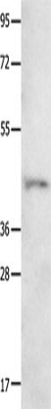Anti-Human NTSR1 Antibody - ABMIUM