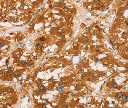 Anti-Human SPN Antibody