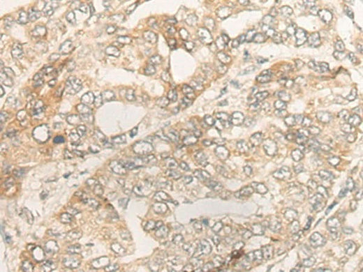 Anti-Human/Rat DUOX2 Antibody - ABMIUM