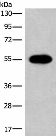 Western blot analysis of A549 cell lysate using HAS3 Polyclonal Antibody at dilution of 1:300