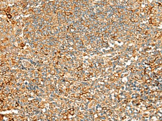 Immunohistochemistry of paraffin-embedded Human tonsil tissue using ASMTL Polyclonal Antibody at dilution of 1:100(×200)